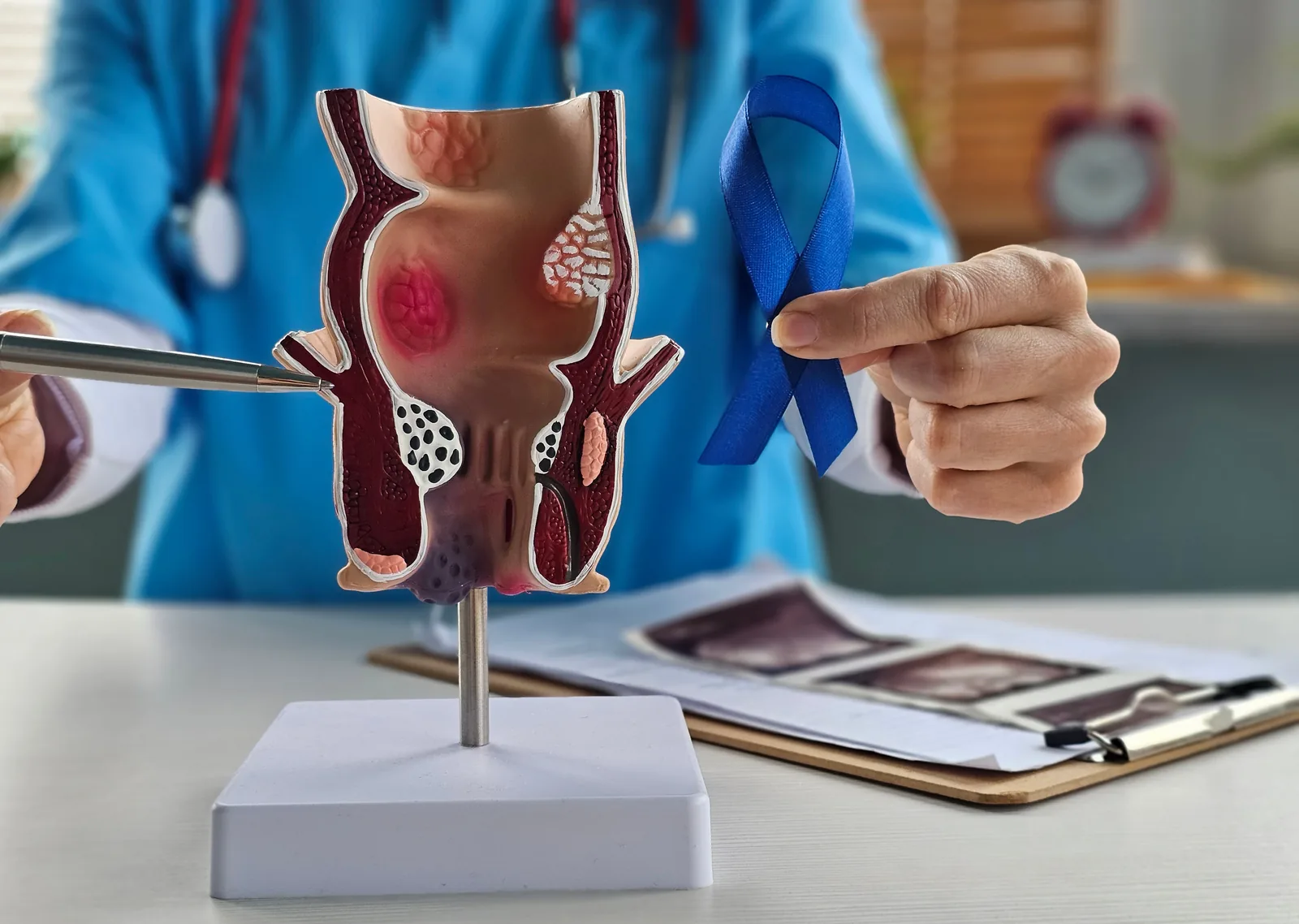 Proktologe im diskreten Patientengespräch – Was macht ein Proktologe?